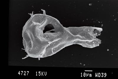 <i><i>Ancyrochitina ancyrea</i> | Ancyrochitina cf. ancyrea</i><br />Ohesaare borehole, 41.00 m, Kaugatuma Stage (754-78)