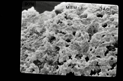 <i><i>Conochitina</i> | Conochitina sp.</i><br />Ohesaare borehole, 181.45 m, Jaagarahu Stage (754-641)