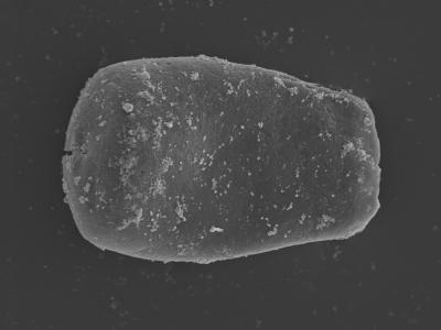 <i><i>Conochitina</i> | Conochitina sp. 7 (Nestor, 1994)</i><br />Kolka 54 borehole, 472.40 m, Jaagarahu Stage (754-458)