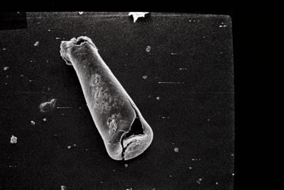 <i><i>Conochitina</i> | Conochitina sp. sp. </i><br />Ruhnu 500 borehole, 402.80 m, Jaagarahu Stage (754-136)