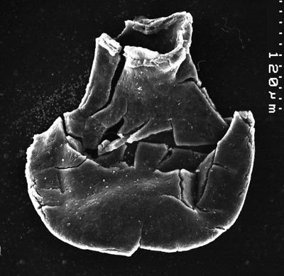 <i><i>Chitinozoa</i> | Lagenochitina? sp.</i><br />Varangu stratotype outcrop,  m, Tremadocian (1537-1)