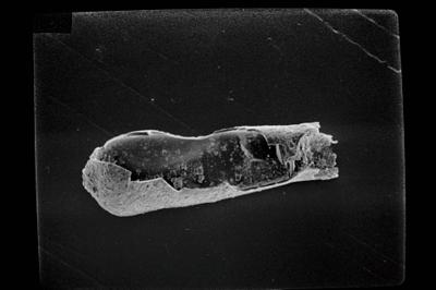 <i><i>Conochitina</i> | Conochitina sp.</i><br />Ohesaare borehole, 225.05 m, Jaagarahu Stage (754-1795)