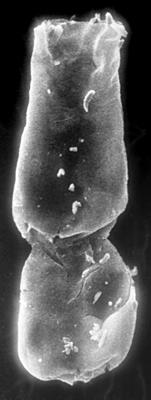 <i><i>Chitinozoa</i> | Conochitina cf. visbyensis Laufeld, 1974</i><br />Jaagarahu borehole, 44.60 m, Jaani Stage (197-11)