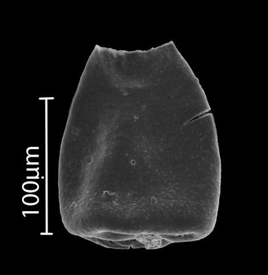 <i><i>Eisenackitina</i></i><br />Bebirva 111 borehole, 1024.45 m, Ludfordian (902-18)