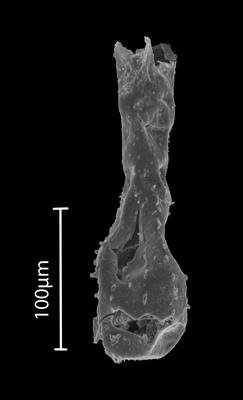 <i><i>Ramochitina</i></i><br />Bebirva 111 borehole, 1025.05 m, Ludfordian (902-54)