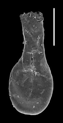 <i><i>Lagenochitina longiformis</i></i><br />Museum of Art excavation section, Kadriorg, 0.30 m, Hunneberg Stage (424-83)