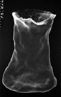 <i><i>Chitinozoa</i></i><br />,  m,  (1532-92)
