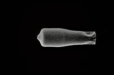 <i><i>Conochitina</i> | Conochitina sp. sp.</i><br />Ohesaare borehole, 202.80 m, Jaagarahu Stage (754-198)