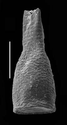 <i><i>Armoricochitina</i> | Armoricochitina cf. reticulifera (Grahn)</i><br />Grötlingbo 1 borehole, Gotland, 421.60 m, Nabala Stage (688-4)