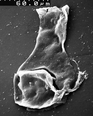 <i><i>Chitinozoa</i></i><br />,  m,  (1534-14)