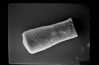 <i><i>Conochitina</i> | Conochitina sp. sp.</i><br />Ohesaare borehole, 200.00 m, Jaagarahu Stage (754-190)