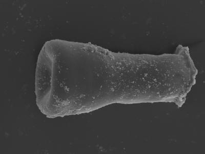 <i><i>Conochitina</i> | Conochitina sp.</i><br />Kolka 54 borehole, 473.80 m, Jaagarahu Stage (754-467)