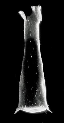 <i><i>Spinachitina taugourdeaui</i></i><br />Rapla borehole, 37.10 m, Pirgu Stage (190-1)