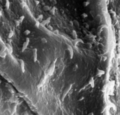 <i><i>Chitinozoa</i> | Sphaerochitina sp. 1 Nestor, 1994</i><br />Ikla borehole, 370.80 m, Raikküla Stage (272-204)