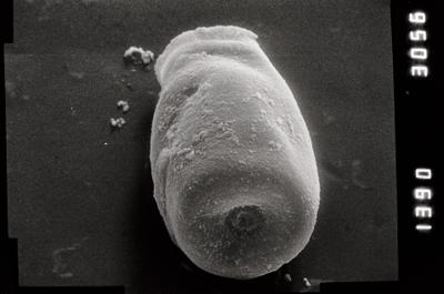 <i><i>Conochitina</i> | Conochitina sp. 5.</i><br />Nagli 106 borehole, 641.20 m, Adavere Stage (754-855)