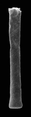 <i><i>Pistillachitina elegans</i></i><br />Kerguta 565 borehole, 148.05 m, Kukruse Stage (544-37)