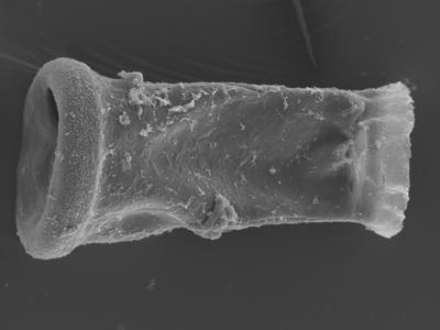 <i><i>Conochitina</i> | Conochitina sp. n</i><br />Ohesaare borehole, 162.00 m, Jaagarahu Stage (754-339)