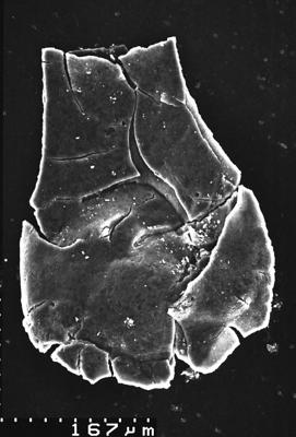 <i><i>Lagenochitina</i> | Lagenochitina sp.</i><br />Varangu stratotype outcrop,  m, Tremadocian (1537-14)