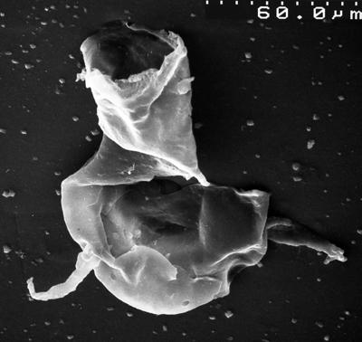 <i><i>Chitinozoa</i></i><br />,  m,  (1534-12)