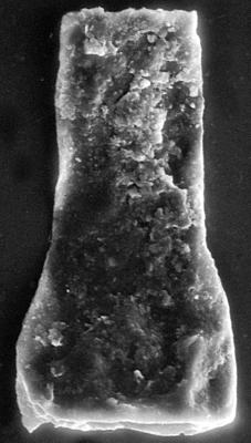<i><i>Chitinozoa</i> | Vitreachitina sp. 2 Nestor, 1994</i><br />Viki borehole, 171.60 m, Adavere Stage (272-196)