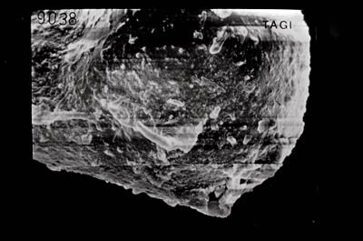 <i><i>Ancyrochitina</i> | Ancyrochitina sp.</i><br />Ruhnu 500 borehole, 344.50 m, Jaagarahu Stage (754-665)