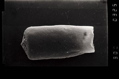 <i><i>Conochitina</i> | Conochitina sp. b</i><br />Ohesaare borehole, 200.80 m, Jaagarahu Stage (754-1066)