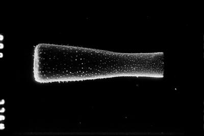 <i><i>Belonechitina wesenbergensis</i></i><br />Ruskavere 451 borehole, 120.20 m, Nabala Stage (660-879)