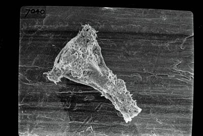 <i><i>Ancyrochitina</i> | Ancyrochitina sp. sp.</i><br />Ruhnu 500 borehole, 361.90 m, Jaagarahu Stage (754-690)