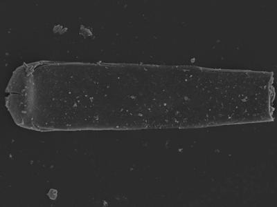 <i><i>Conochitina</i> | Conochitina? sp.</i><br />Kolka 54 borehole, 492.60 m, Jaagarahu Stage (754-1251)