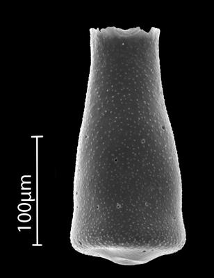 <i><i>Eisenackitina</i></i><br />Bebirva 111 borehole, 1024.45 m, Ludfordian (902-16)