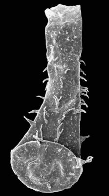 <i><i>Chitinozoa</i> | Ramochitina sp. 2 Nestor, 2009</i><br />Pavilosta 51 borehole, 653.00 m, Ludfordian (576-56)