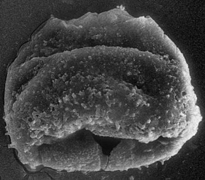 <i><i>Chitinozoa</i> | Eisenackitina? sp. 2 Nestor, 1994</i><br />Nagli 106 borehole, 611.90 m, Adavere Stage (272-175)
