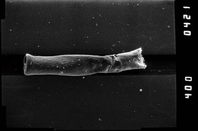 <i><i>Conochitina</i> | Conochitina sp. 4</i><br />Kirikuküla borehole, 47.90 m, Adavere Stage (754-1184)