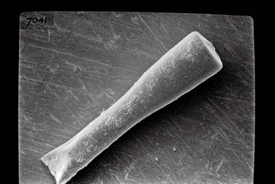 <i><i>Conochitina</i> | Conochitina sp. sp.</i><br />Ruhnu 500 borehole, 392.80 m, Jaagarahu Stage (754-678)