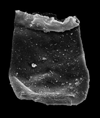 <i><i>Eisenackitina</i> | Eisenackitina sp.</i><br />Kolka 54 borehole, 416.00 m, Jaagarahu Stage (546-100)