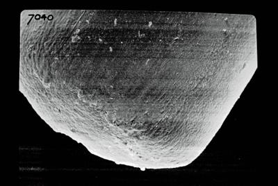<i><i>Conochitina</i> | Conochitina sp. sp.</i><br />Ruhnu 500 borehole, 388.90 m, Jaagarahu Stage (754-682)