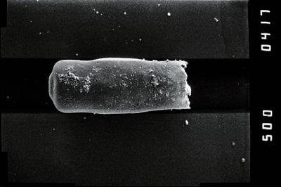 <i><i>Conochitina</i> | Conochitina sp. 2</i><br />Kirikuküla borehole, 47.50 m, Adavere Stage (754-1188)