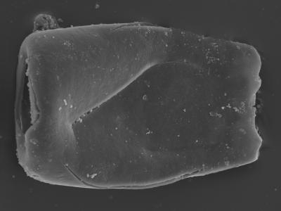 <i><i>Conochitina</i> | Conochitina sp. 7 (Nestor, 1994)</i><br />Kolka 54 borehole, 472.20 m, Jaagarahu Stage (754-457)
