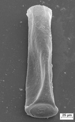 <i><i>Conochitina</i> | Conochitina sp.3</i><br />Staicele 4 borehole, 394.50 m, Raikküla Stage (754-1363)
