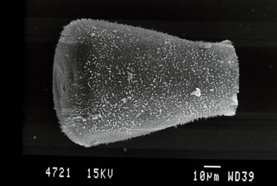 <i><i>Eisenackitina lagenomorpha</i></i><br />Ohesaare borehole, 89.30 m, Paadla Stage (754-76)