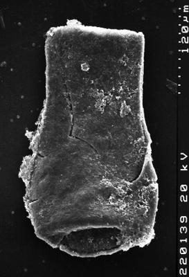 <i><i>Chitinozoa</i></i><br />Albrunnabrottet section,  m, Tremadocian (1527-12)
