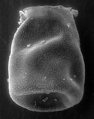 <i><i>Chitinozoa</i> | Eisenackitina sp. 1 Nestor, 1993</i><br />Jaagarahu borehole, 41.70 m, Jaani Stage (273-14)