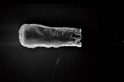 <i><i>Conochitina</i> | Conochitina sp. sp.</i><br />Ohesaare borehole, 202.80 m, Jaagarahu Stage (754-194)