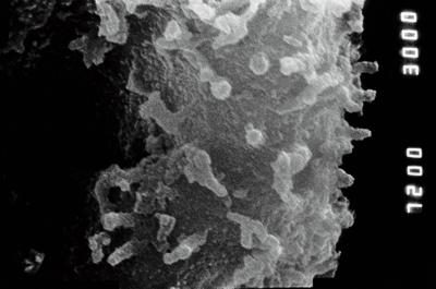 <i><i>Eisenackitina</i> | Eisenackitina sp. 1</i><br />Pulli 2 borehole, 47.65 m, Adavere Stage (754-891)