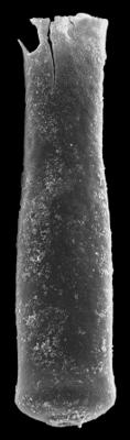 <i><i>Conochitina pachycephala</i></i><br />Kolka 54 borehole, 486.20 m, Jaagarahu Stage (546-78)