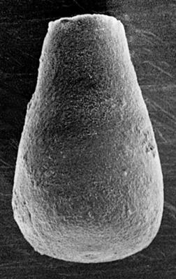 <i><i>Eisenackitina spongiosa</i></i><br />Ruhnu 500 borehole, 361.90 m, Jaagarahu Stage (220-43)