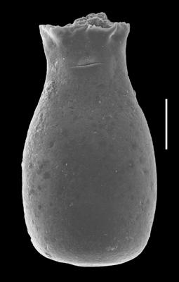 <i><i>Chitinozoa</i> | Belonechitina? sp.</i><br />Grötlingbo 1 borehole, Gotland, 348.38 m, Adavere Stage (688-51)
