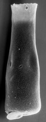 <i><i>Chitinozoa</i> | Conochitina aff. emmastensis Nestor, 1982</i><br />Varbla 502 borehole, 155.00 m, Adavere Stage (223-18)