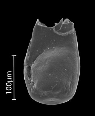 <i><i>Eisenackitina</i></i><br />Bebirva 111 borehole, 1127.95 m, Ludfordian (902-12)