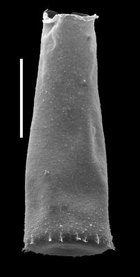 <i><i>Spinachitina fragilis</i></i><br />Likenai 396 borehole, 781.88 m, Juuru Stage (884-8)
